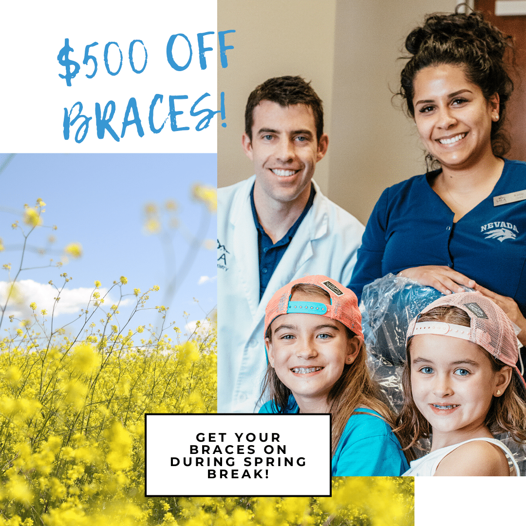 $500 Off braces