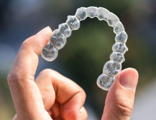 5 Reasons To Get Invisalign