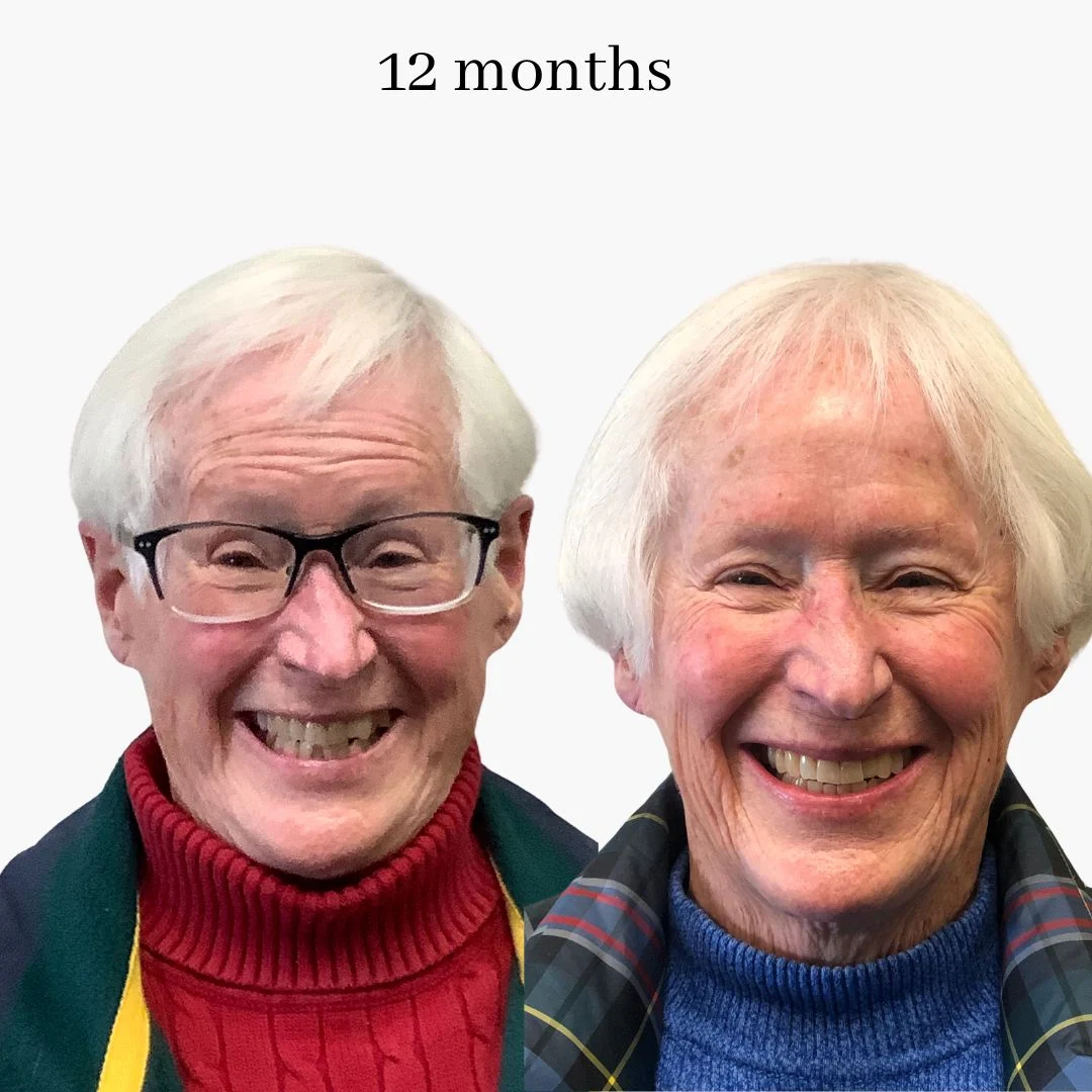 invisalign before & after – 2024.02 (10)