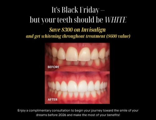 Unlock a Brighter, Straighter Smile This Black Friday at Sala Family Dentistry